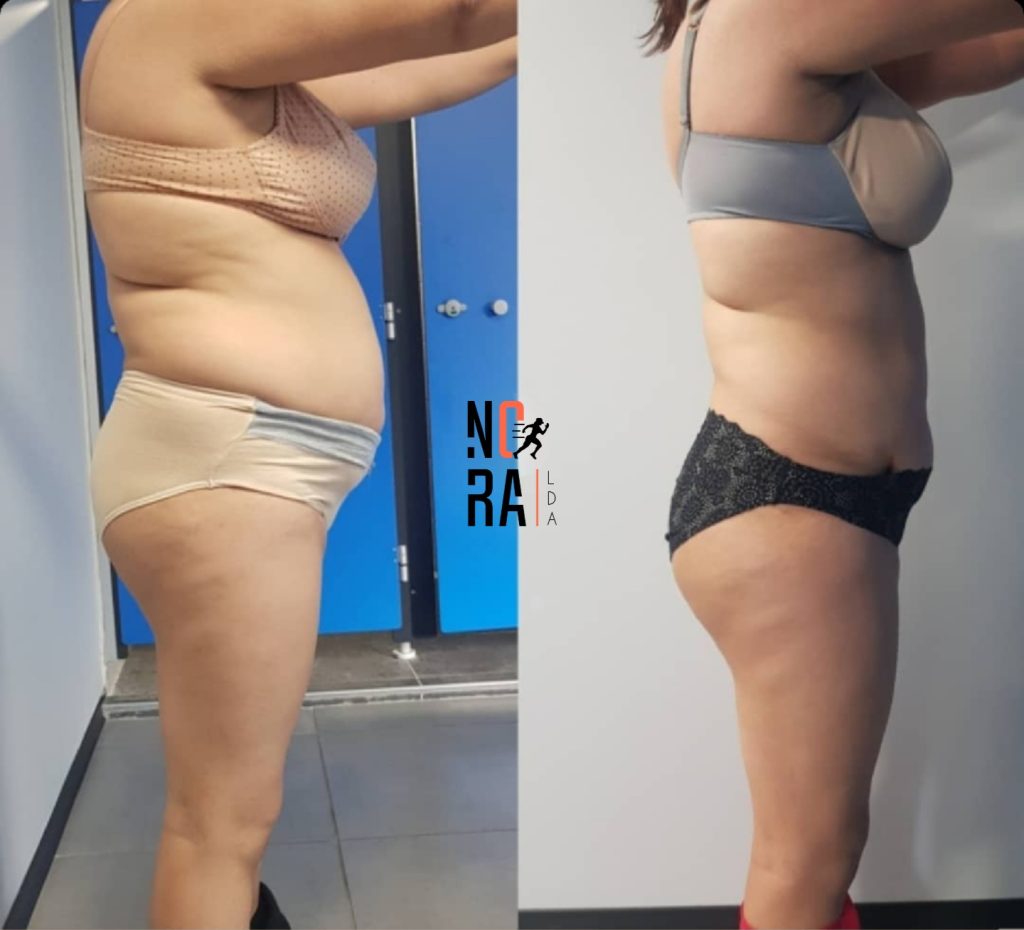 Transformation avant / après d’une cliente LDA (5)